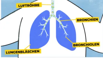 RS-Viren breiten sich  in den Atemwegen aus